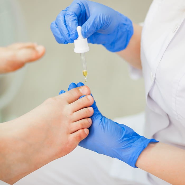 Podopharm PODOFLEX olejek na wrastające paznokcie 10 ml